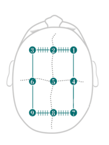 Лосион против мъжки косопад LOTION CONCENTREE HOMME MEDAVITA 100 ml.
