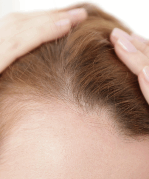 косопад след бременност